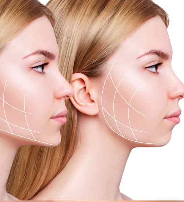 Buccal Fat Removal at Vilva Cosmetics