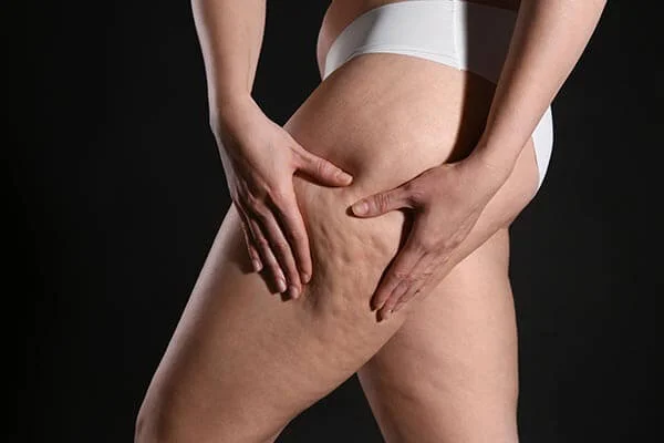 Thigh Reduction and Lift