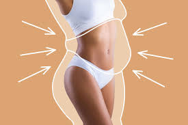 Liposuction