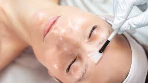 OBAGI CHEMICAL SKIN PEEL