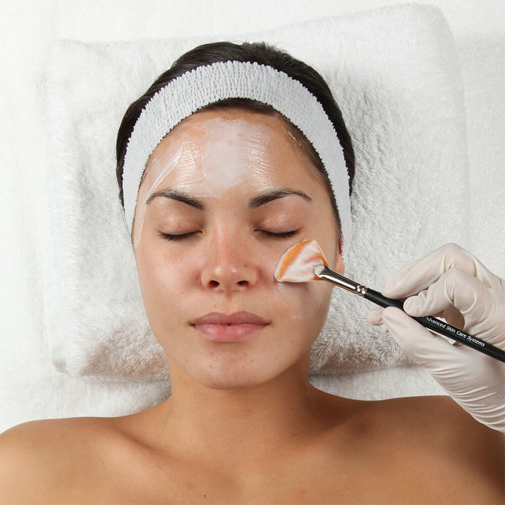 Chemical Peel at Vilva Cosmetics