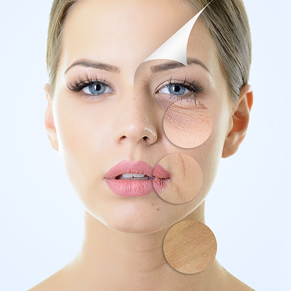 Anti-Wrinkle Injections at Vilva Cosmetics
