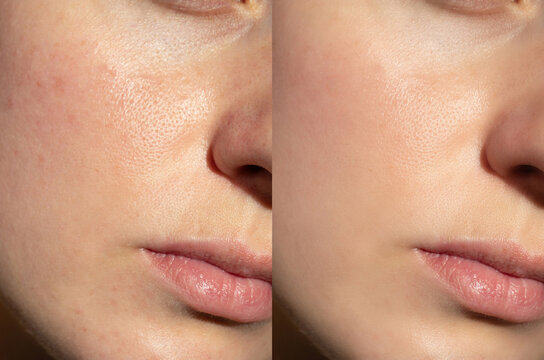 Environ Facial Smooth Skin