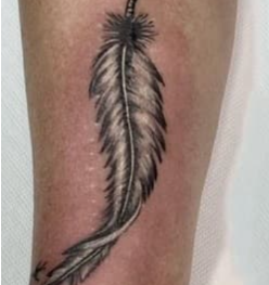 Before Tattoo Removal