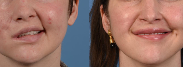 Facial Trauma Case 2