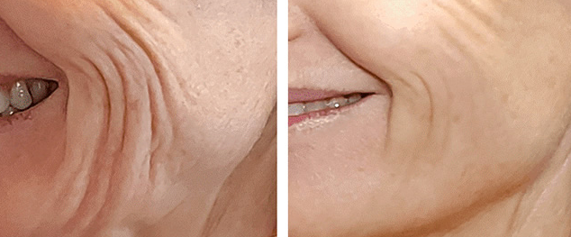 Vitamin B12 Example 2