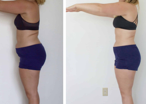 Vitamin B12 Example 3