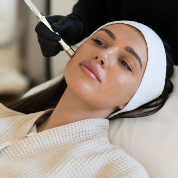 Microdermabrasion at Vilva Cosmetics