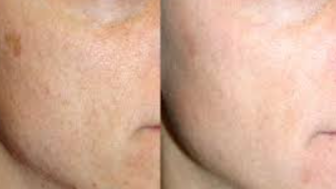 Croton Oil Peel Texture