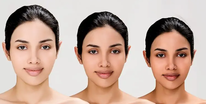 Skin Lightening at Vilva Cosmetics