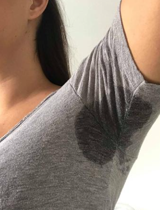 Before Sweat Treatment