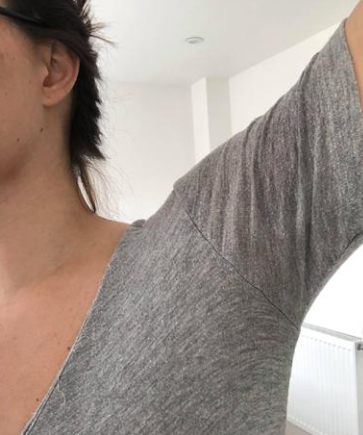 After Sweat Treatment