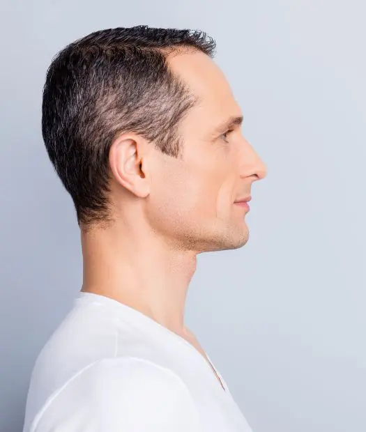 Head and Neck Reconstruction at Vilva Cosmetics