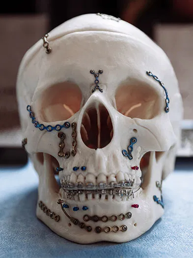 Facial Trauma Reconstruction at Vilva Cosmetics